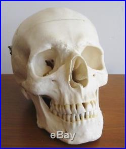 Vtg West German SOMSO Human Skull Anatomical Medical Display Model Jointed Jaw